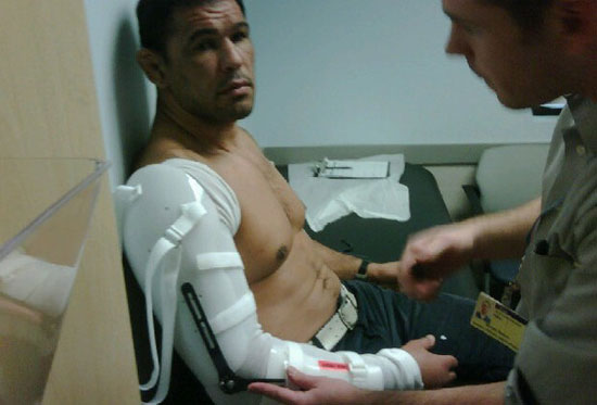 O brasileiro Rodrigo Minotauro fraturou o úmero na luta contra Frank Mir no UFC 140, evento realizado no último sábado (10), em Toronto, no Canadá. Após os exames preliminares, o UFC...