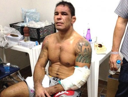 R. Minotauro (foto) teve o braço imobilizado após luta contra F. Werdum. Foto: Reprodução / Instagram