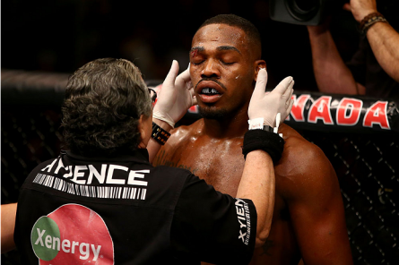 J. Jones recebe tratamento do "cutman" do UFC. Foto: Josh Hedges/UFC