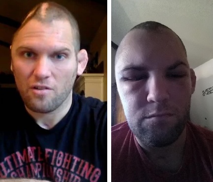 M. Grice antes (esq.) e depois (dir.) da cranioplastia. Foto: Produção MMA PRESS (MMA Fighting/Twitter)