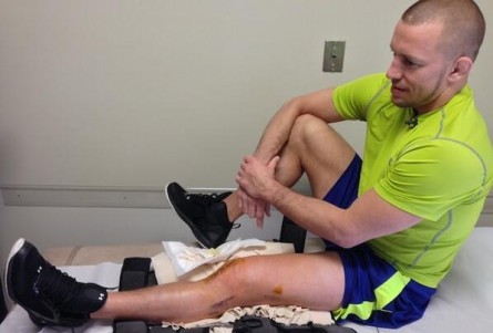 GSP exibe cicatrizes no joelho esquerdo após cirurgia. Foto: Reprodução/Twitter