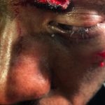 Ex campeão do UFC BJ Penn é preso Havaí após briga em hotel