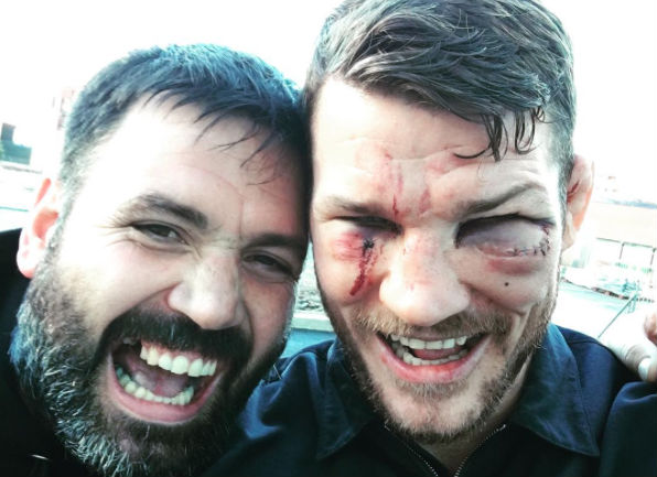 Bisping ficou com o rosto machucado após o UFC 204. Foto: Reprodução/Instagram