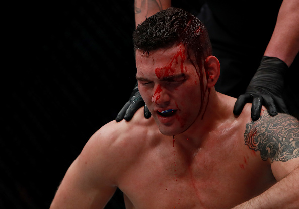 Weidman foi brutalmente nocauteado por Y.Romero no UFC 205. (Foto: Getty Images)
