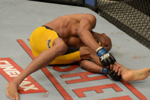 Anderson Silva sofreu a última grave lesão de 2013 no UFC. Foto: Reprodução/UFC