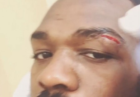 Jones (foto) postou vídeo que mostra grande corte que sofreu. Foto: Reprodução/Instagram