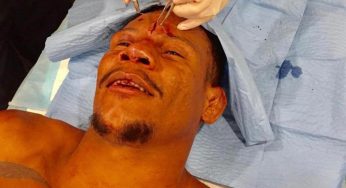 Alex Cowboy recebe 60 dias de suspensão médica após derrota no UFC 231