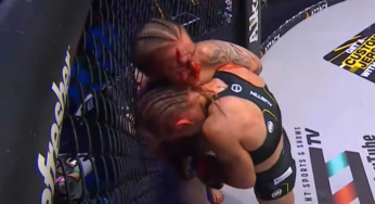 IMAGEM FORTE: Cotovelada brutal abre ‘buraco’ em testa de lutadora de MMA